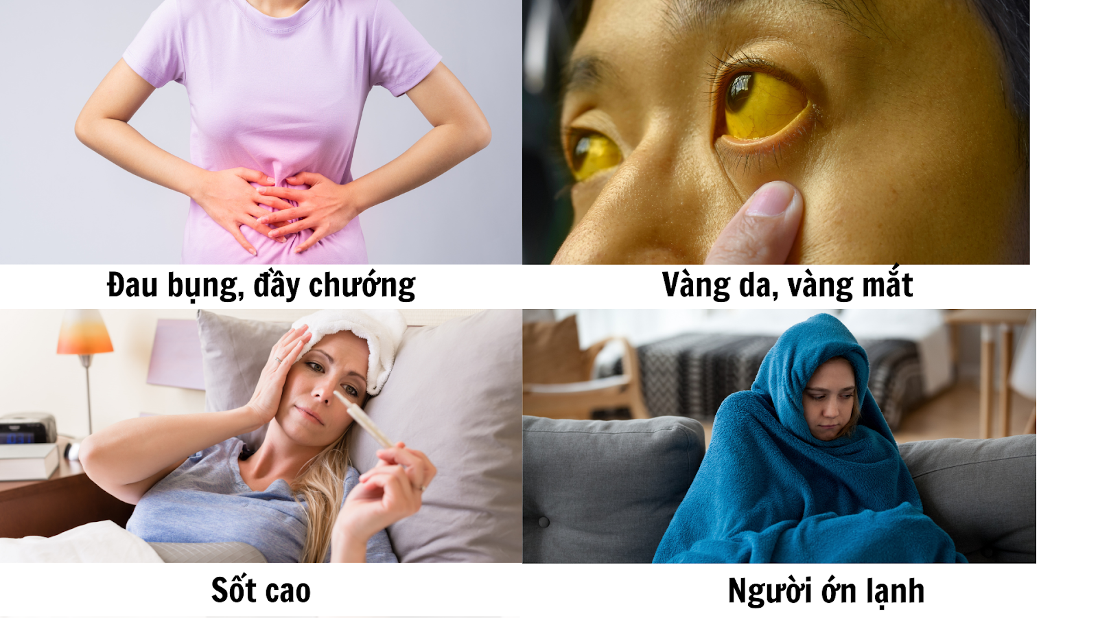 Đau, sốt, vàng da là triệu chứng điển hình của viêm đường mật