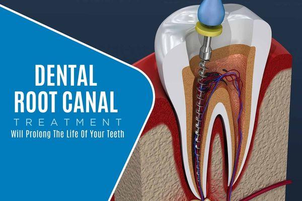5 Must-Know Facts About Root Canal Treatment 3 AD 4nXep1TvKvFwMCqI yUZOyov28crWD JA1ME5qH8brY3qt82DoRuXs1k LbpIlgCRPToQ2KaLgIeUGsRHONx1JLZb Cyi35bg4d6OEUH HvemWq TBPFU3v91yBkTvbYMDT5XLfd7OcKv8DziaNPm