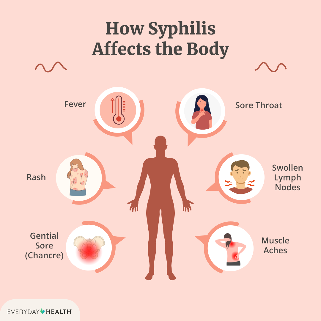 Syphilis