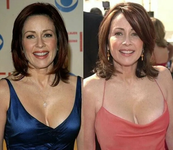 Patricia Heaton Breast implant