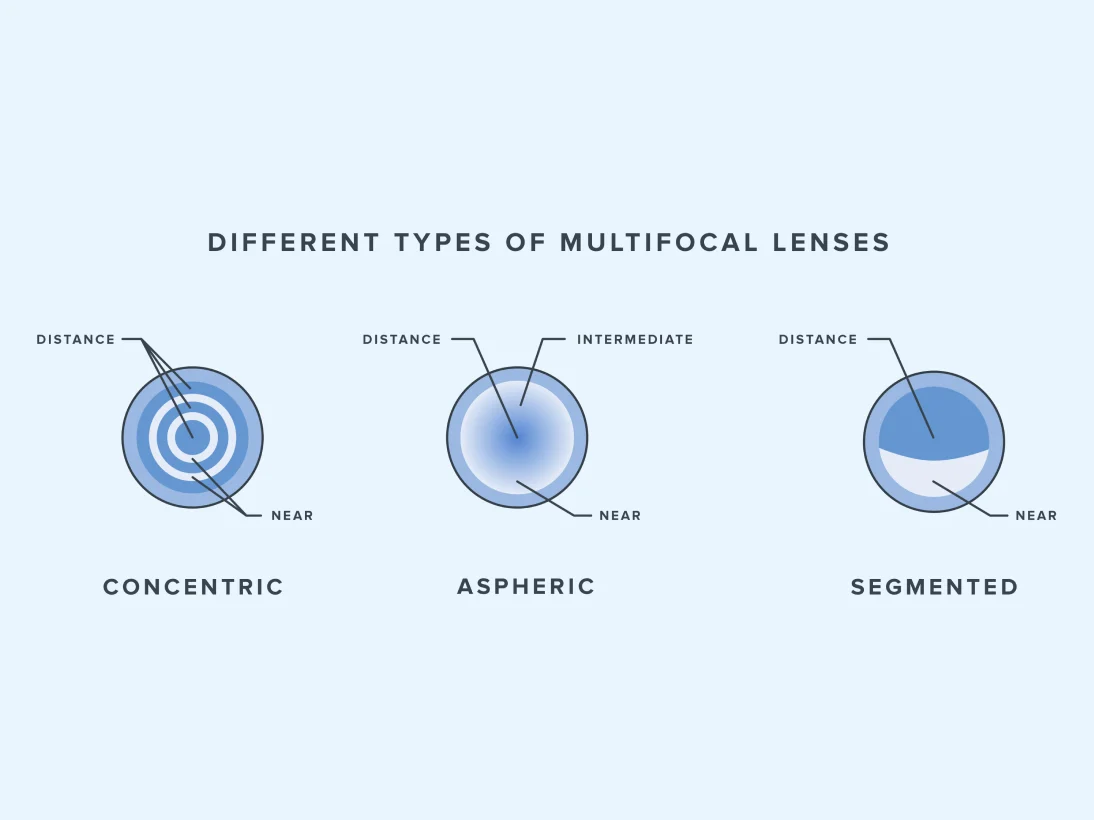 Different Types of Multifocal Contact Lenses