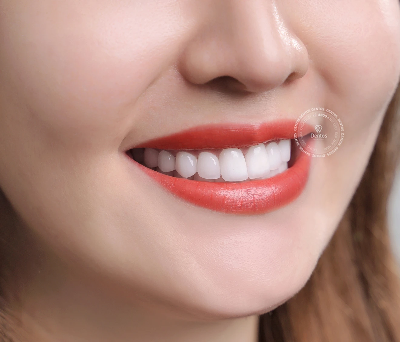 Các loại răng sứ tốt nhất trên thị trường - Chọn loại nào?