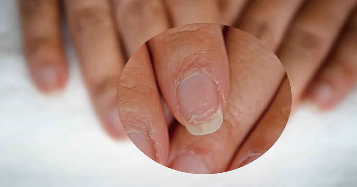 Special Treatments for Nail and Hand Care Issues
