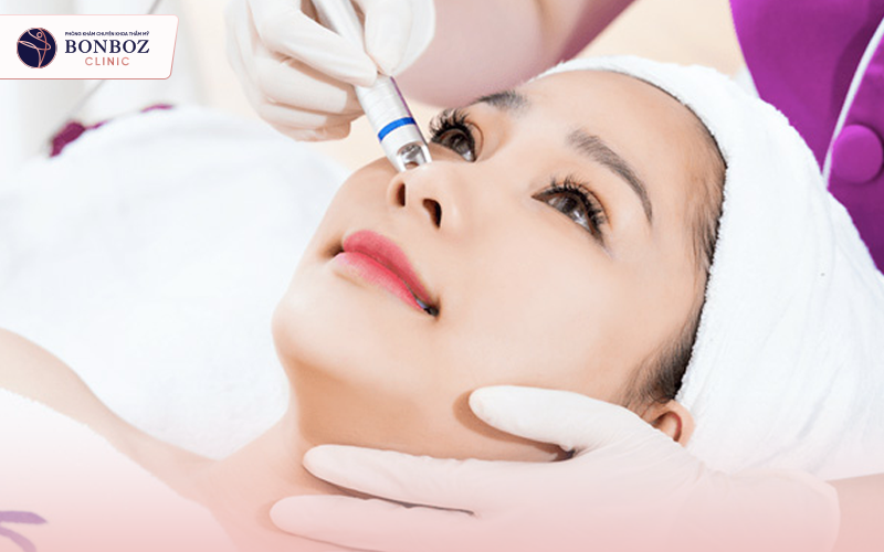 Laser có thể giúp giảm thâm mắt