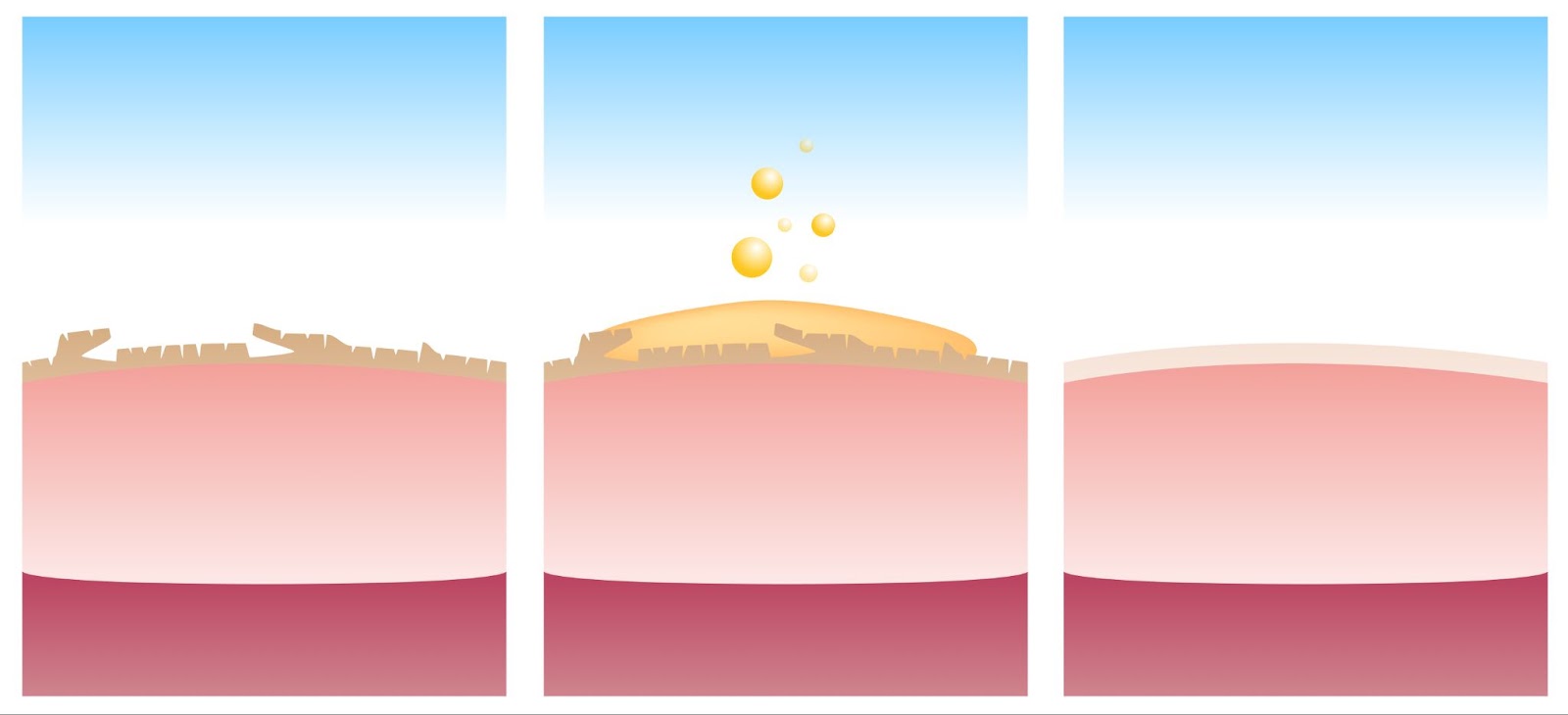 skin layer exfoliation