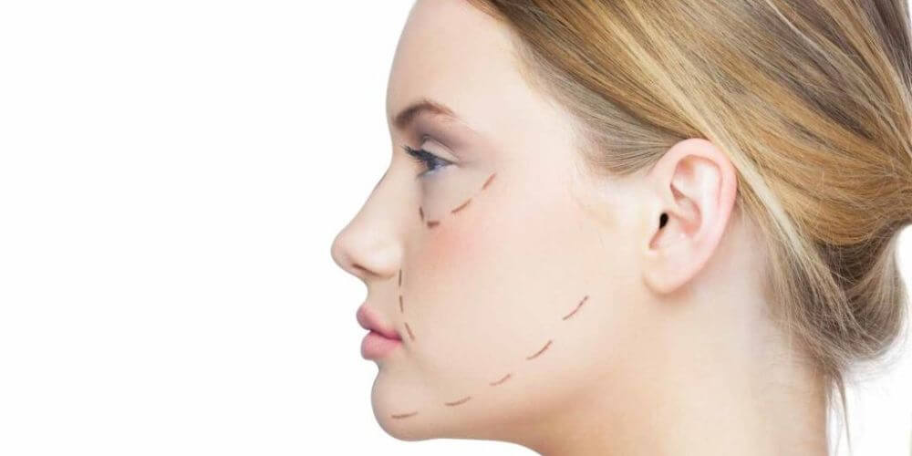 chirurgie plastique faciale