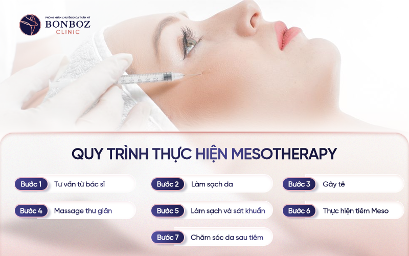 Quy trình thực hiện phương pháp Meso