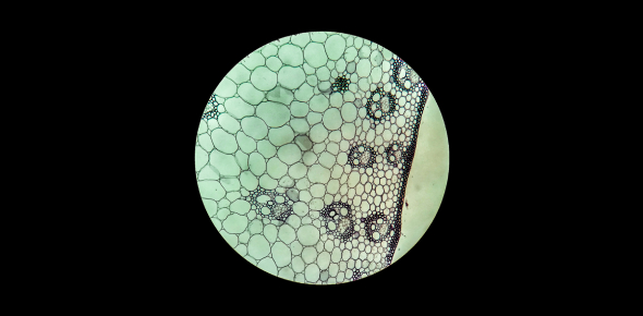 Xylem, phloem, and ground tissues in monocot stem under a compound microscope with 400x magnification.