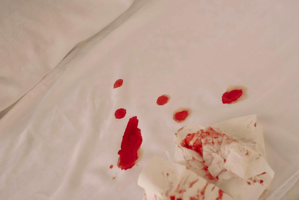 blood in bed