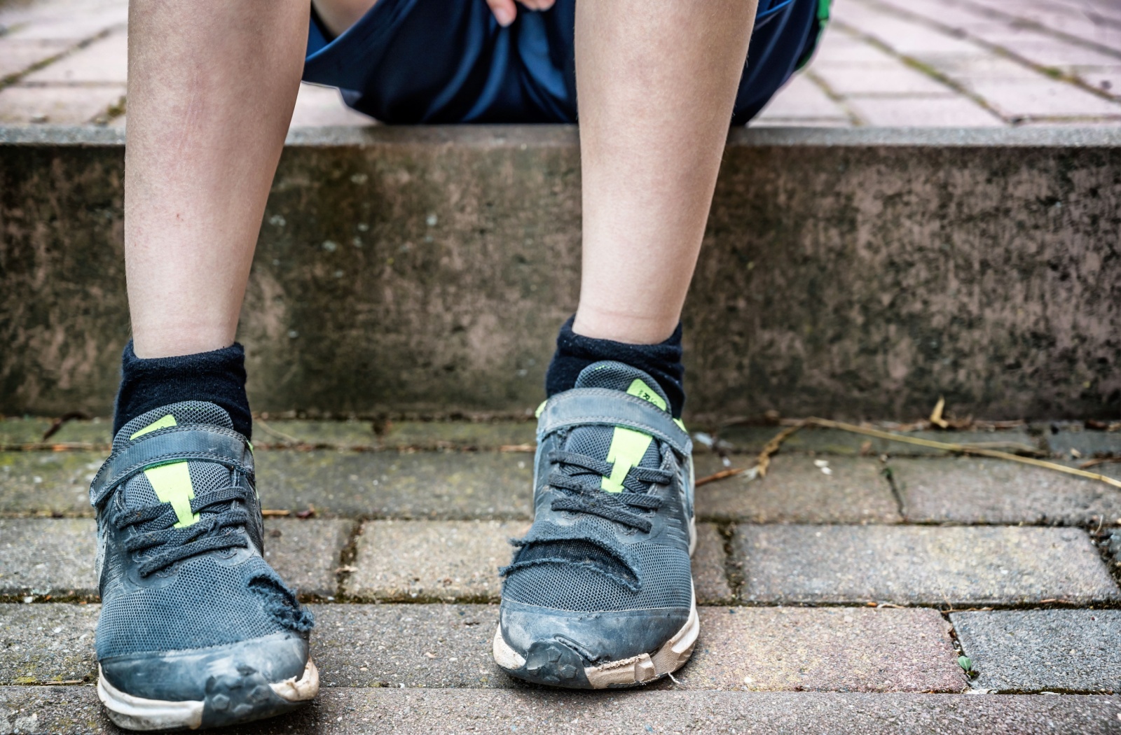 A child's legs and feet wearing worn out shoes