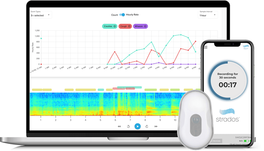 RESP® Biosensor_theHotBleep