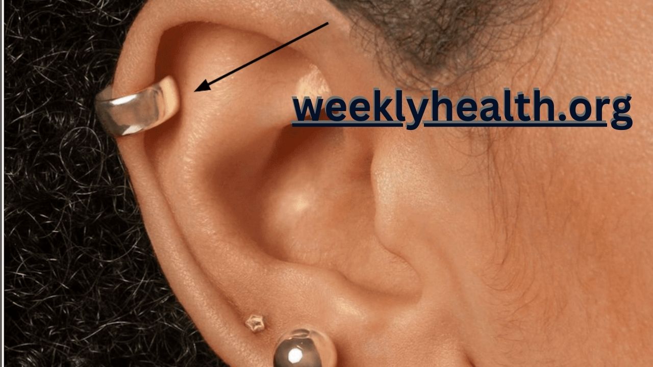 helix piercing