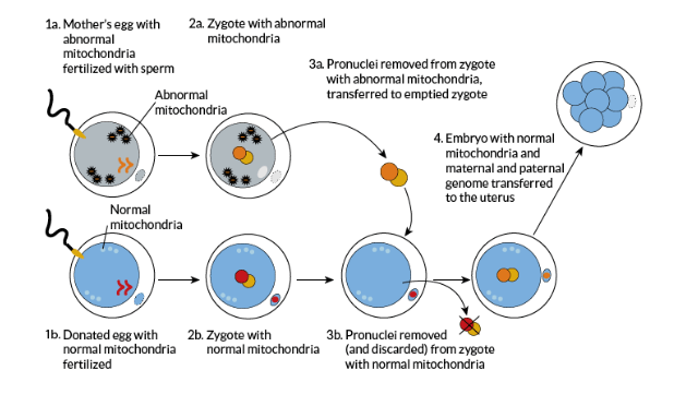 Mitochondrial disease