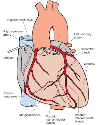 Myocardial Infarction