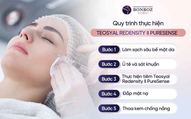 Quy trình thực hiện tiêm filler Teosyal Redensity II PureSense