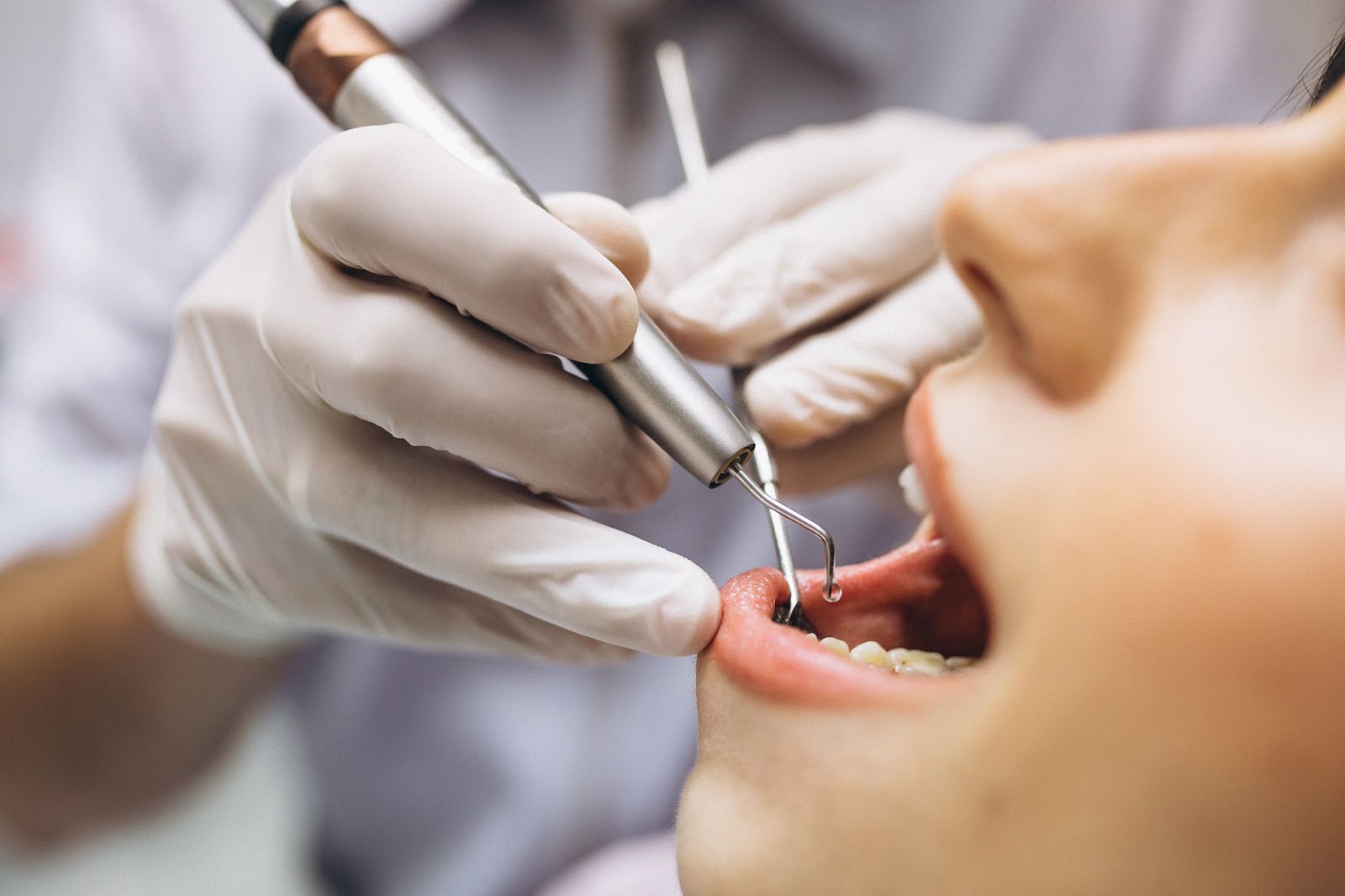 Everything You Need to Know About Dental Crowns: Your Ultimate Guide