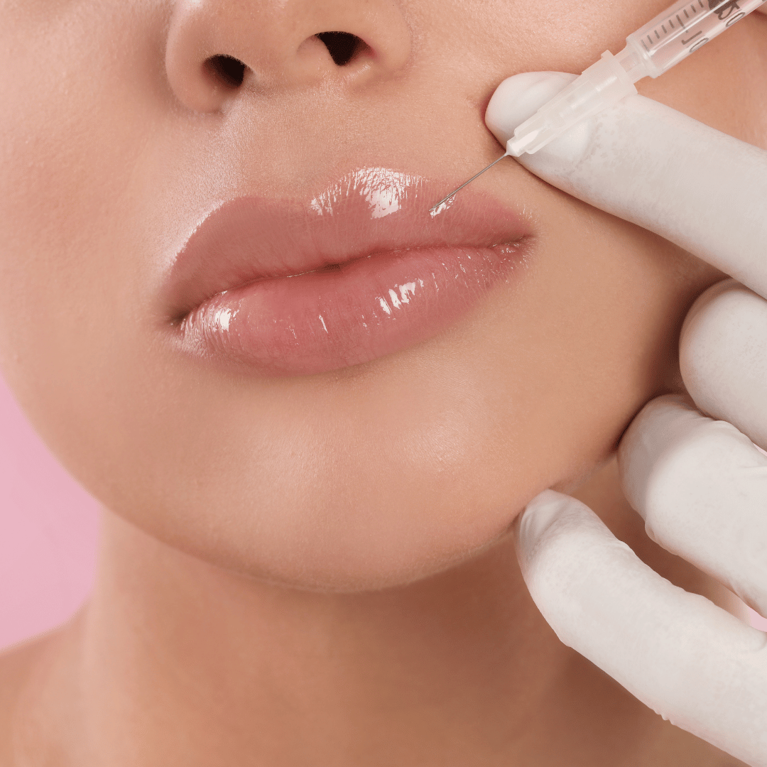 lip filler injection