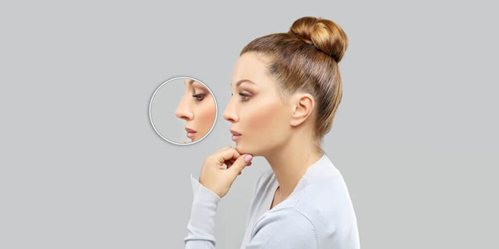 rhinoplastie