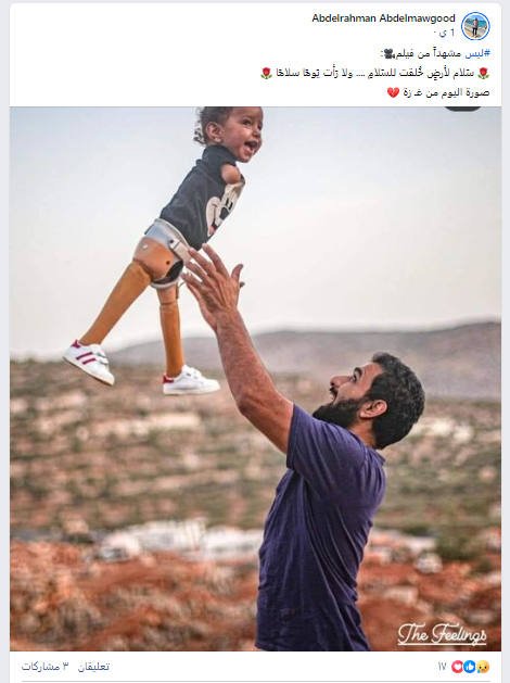 صورة لأب فلسطيني يحمل ابنه المصاب خلال الحرب الجارية على قطاع غزة