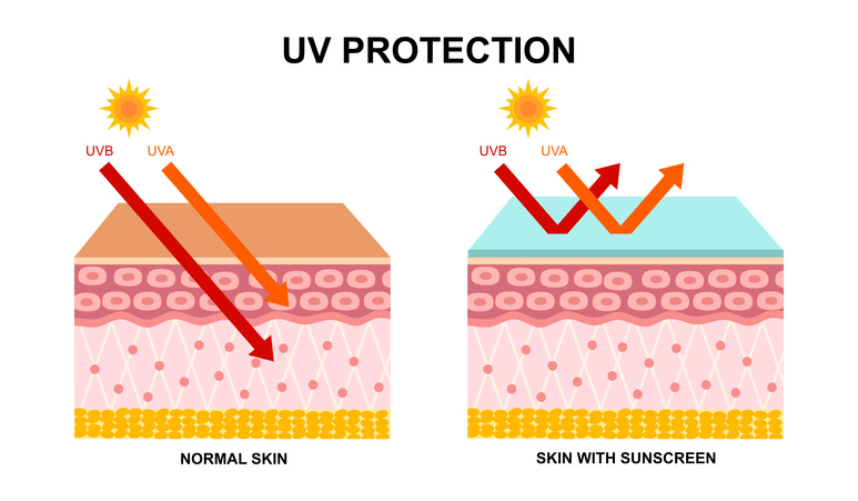 Illustration showing UVA and UVB rays penetrating normal skin vs. skin with sunscreen
