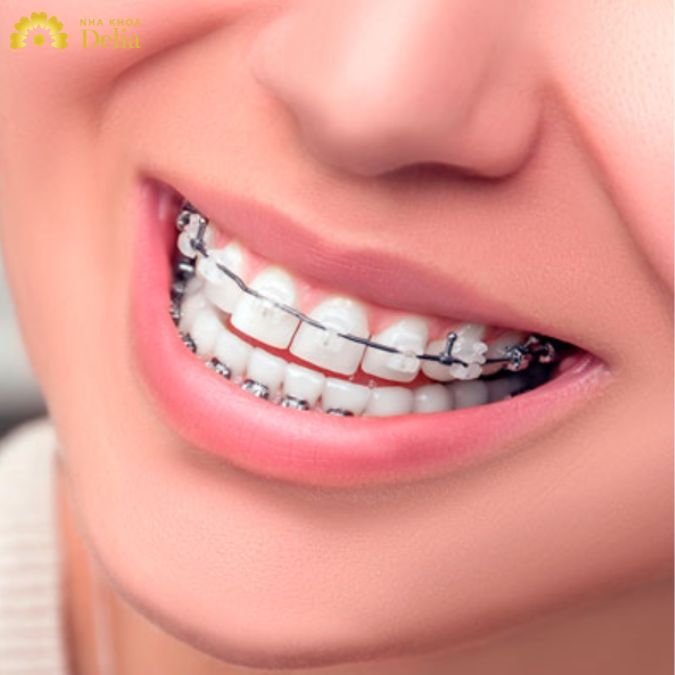 AD_4nXfjTE71NGf3PPyfru3nQ-xGa_cCcknNTQZ0glKBELTWONt2nbtH8pzrmW3nmydSabC722LeglPoCE-TxJb55wx-hbtxO_CiPGJkqMGTWH2aAIb8YsU1b_YAgEyN4Ne2HnTE11HPEDitzRFabSuSVZs2ISiM