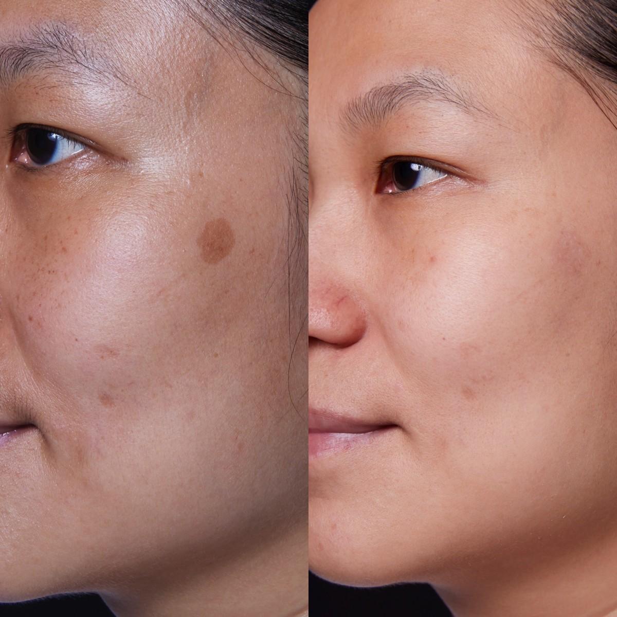 A person's face before and after a comparison

Description automatically generated