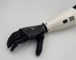 Gambar Myoelectric Prosthesis