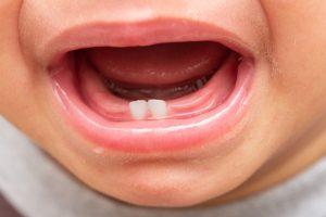 baby teeth
