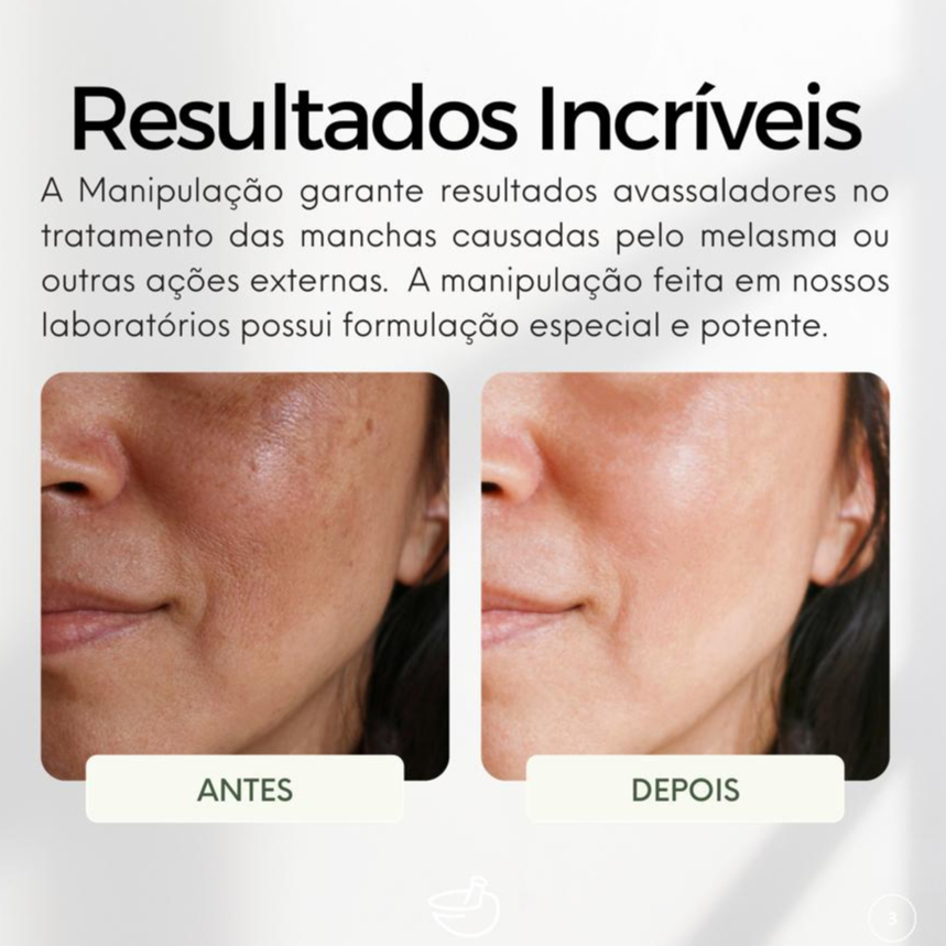 Imagem do produto Creme Nova Pele Facial Clareador Melasma 25g 5