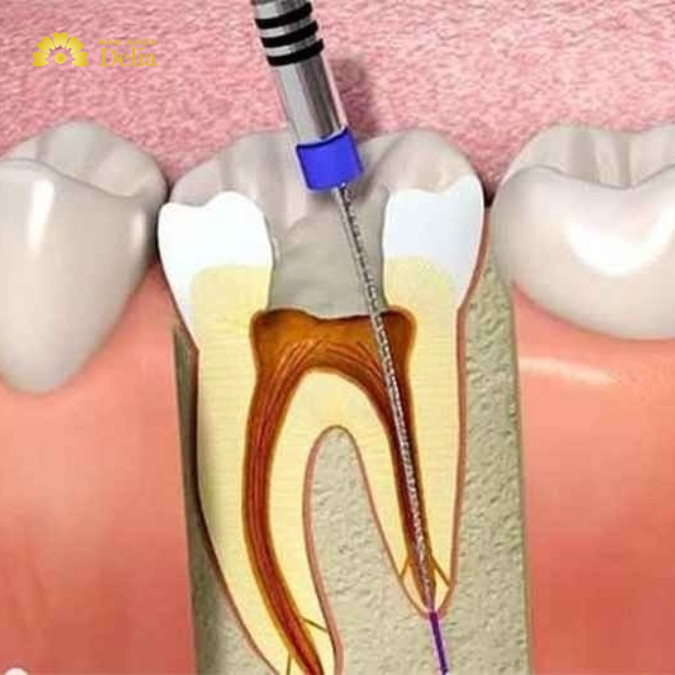 Hiểu biết cơ bản về tủy răng