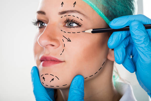 plastic surgeons ozempic face