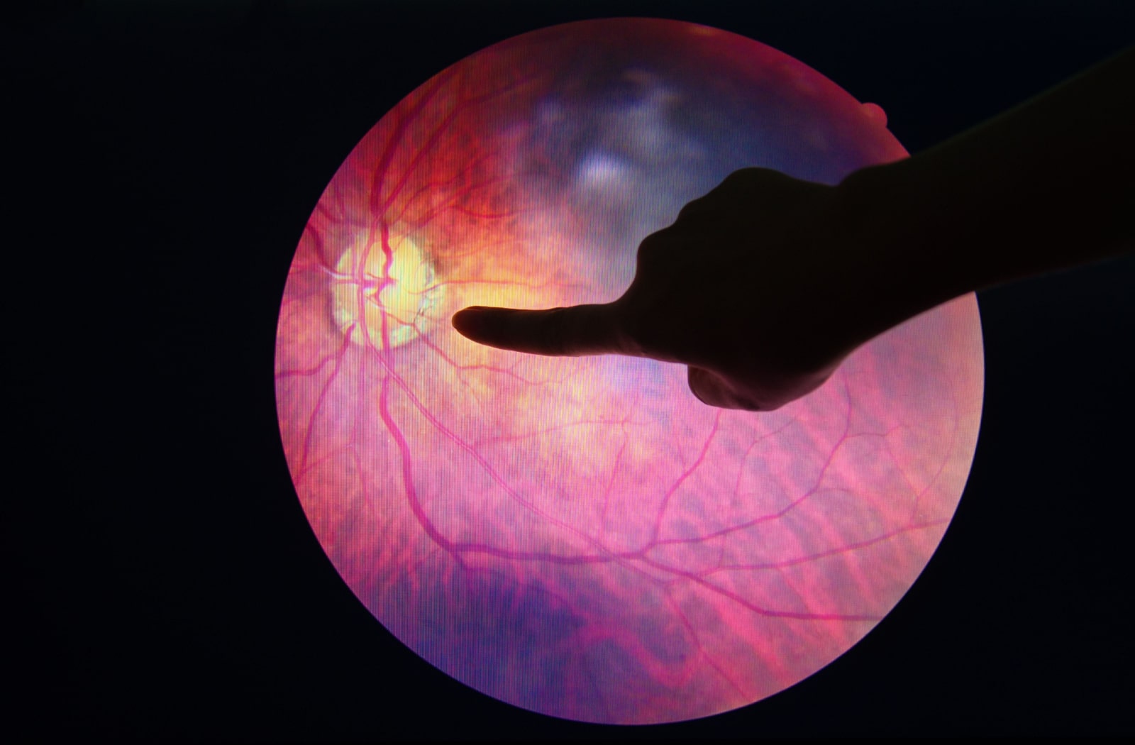An optometrist pointing to the retina and macula on a digital scan of a patient's eye