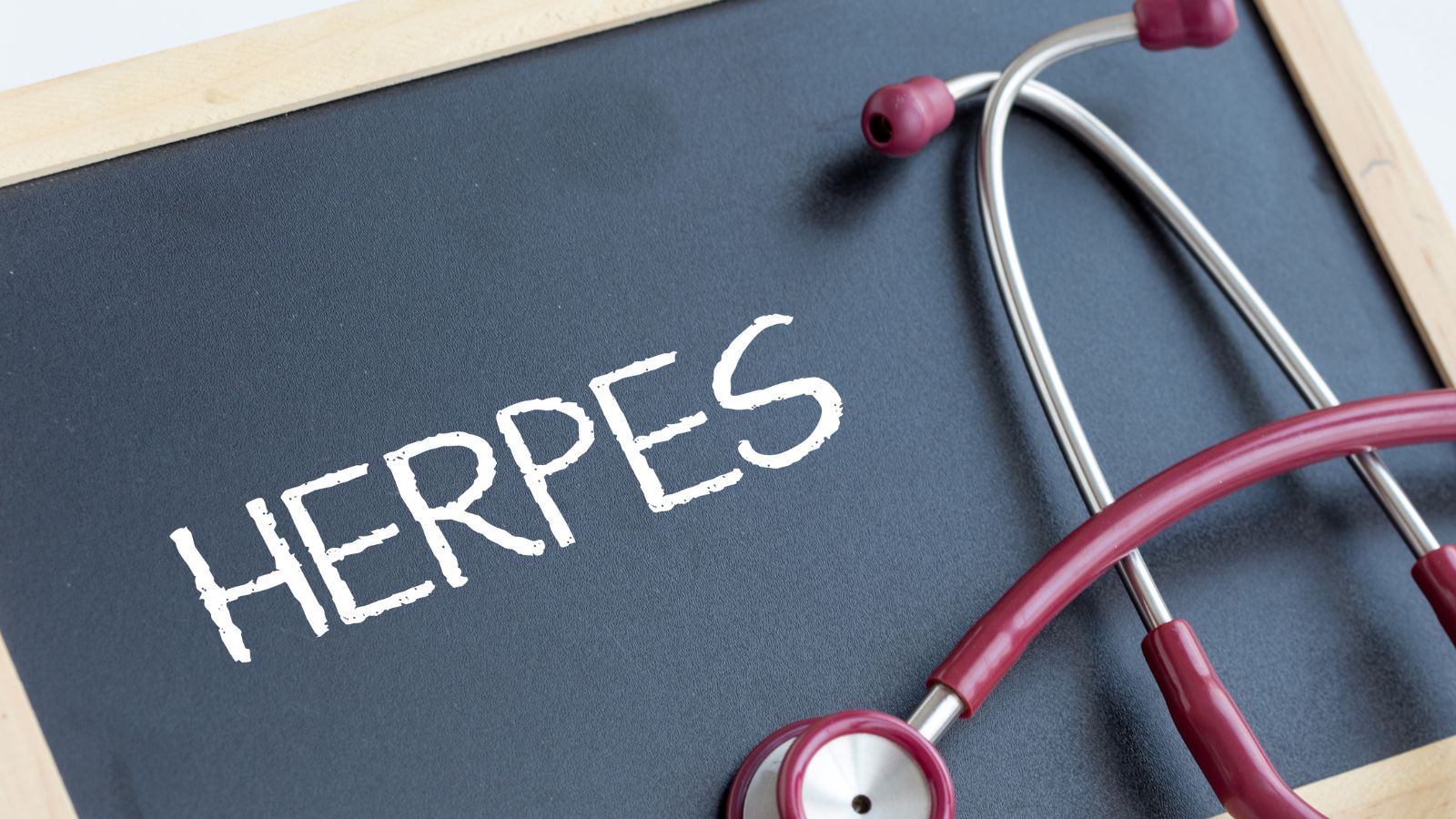 かゆみを伴う性感染症: ヘルペスとHPVの予防と治療