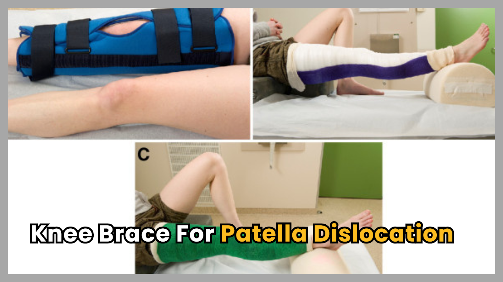 10 Tips for Buying the Best Knee Brace for Patella Dislocation