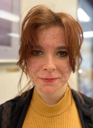 A person with red hair and frecklesDescription automatically generated with medium confidence
