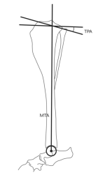 Obrázek 5: Měření sklonu TPA pomocí modelu dr. Slocuma a dr. Devine, MTA – osa tibie (5)