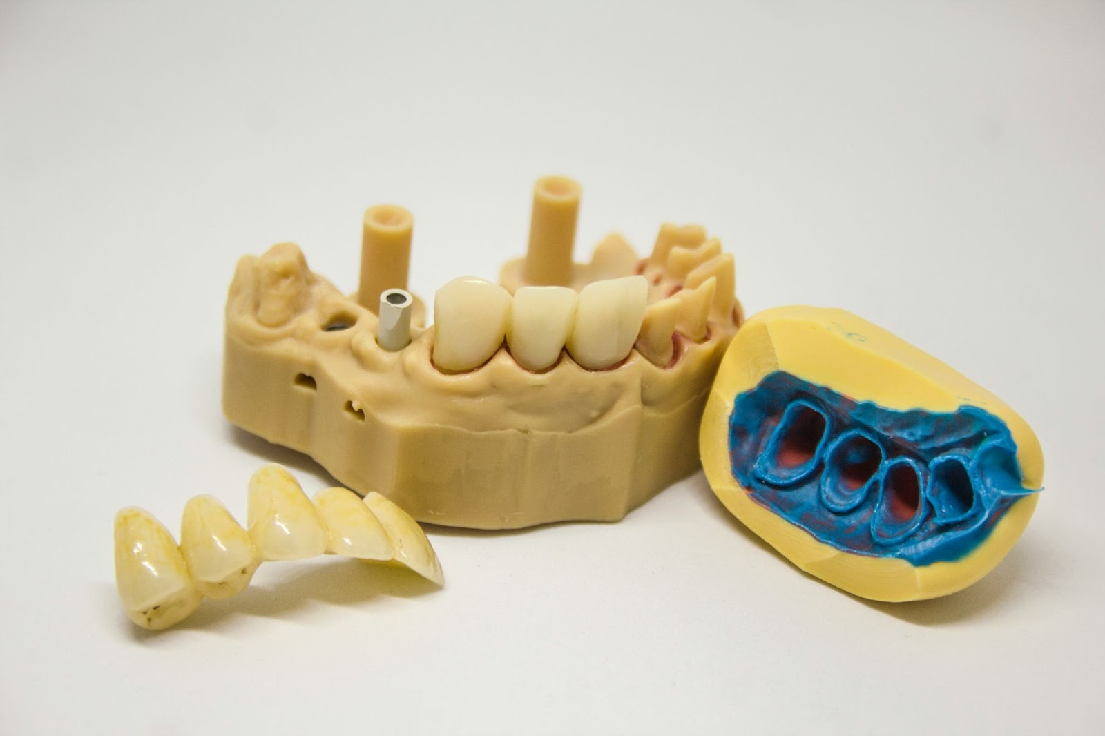 Materiale speciale pentru implanturi dentare