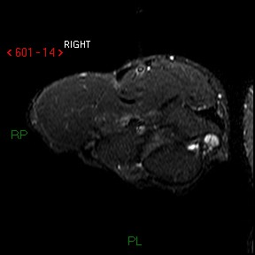 A close-up of a mri Description automatically generated