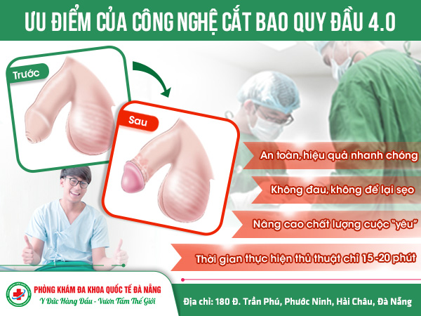 Ưu điểm của công nghệ cắt cắt bao quy đầu hiện đại