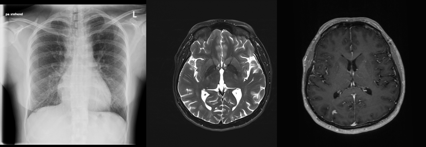 Ein Bild, das Röntgenfilm, medizinische Bildgebung, Radiologie, medizinisches Bildgebungsverfahren enthält.Automatisch generierte Beschreibung