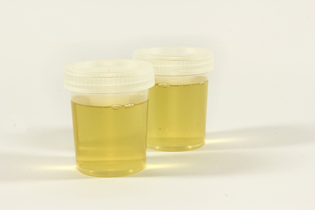 Urine test containers show the conect of drug abuse testing at college