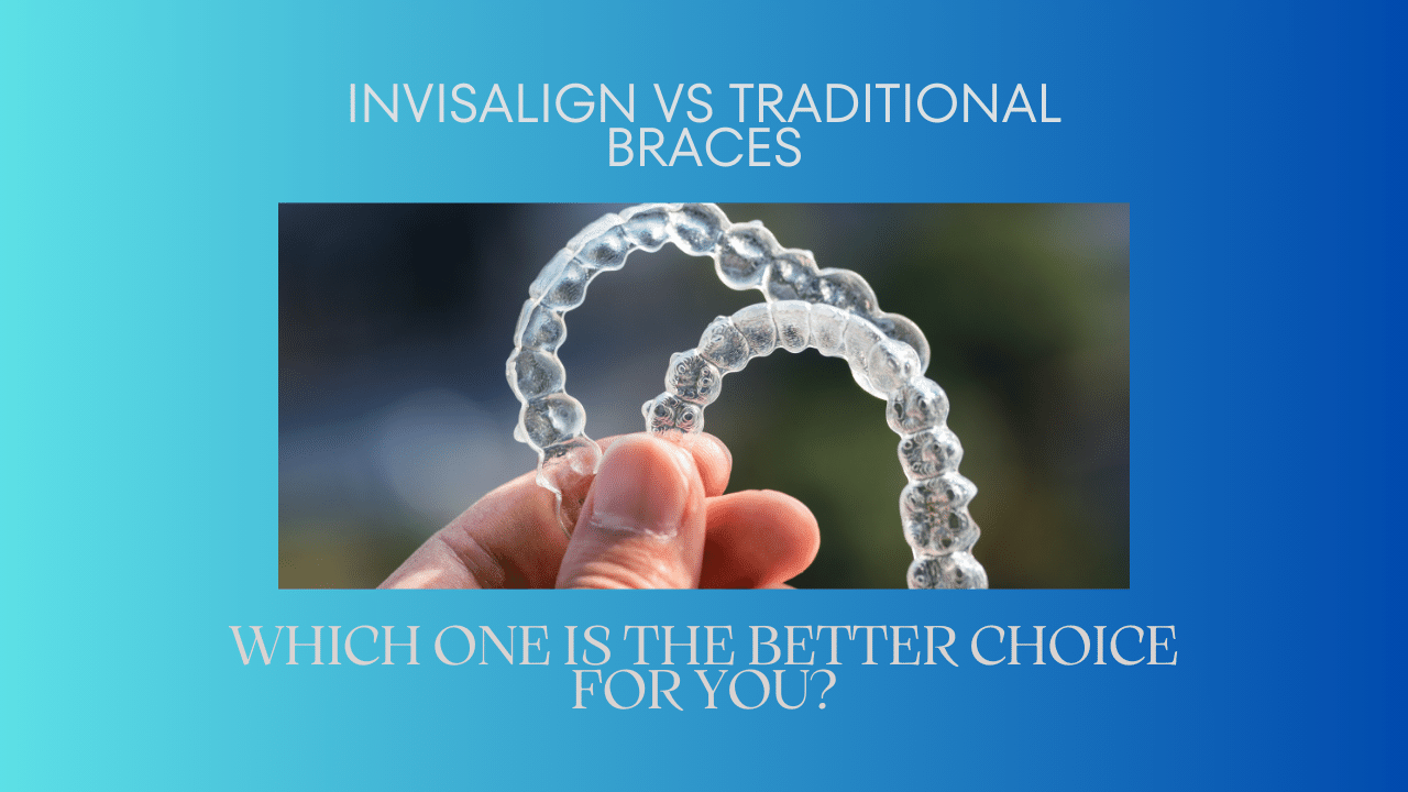 How Much Do Invisalign Retainers Cost?