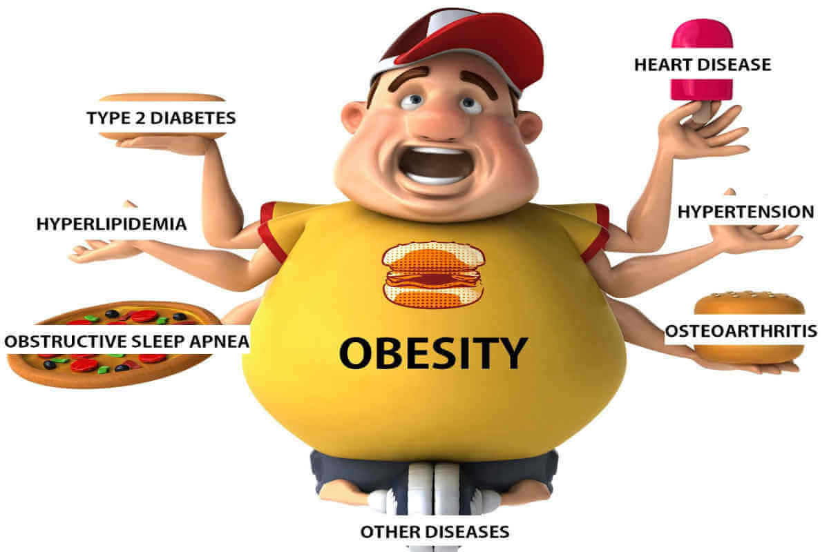Health Risks of Obesity and Obstructive Sleep Apnea