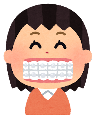 歯列矯正をした方が良い人と必要でない人