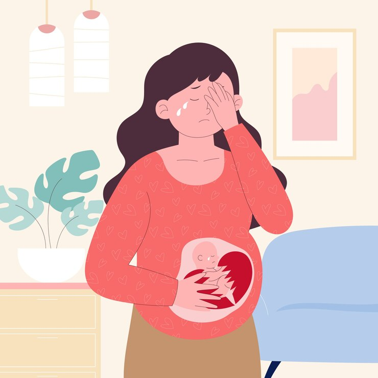 Effects of Unicornuate Uterus with Rudimentary Horn on Fertility & Pregnancy