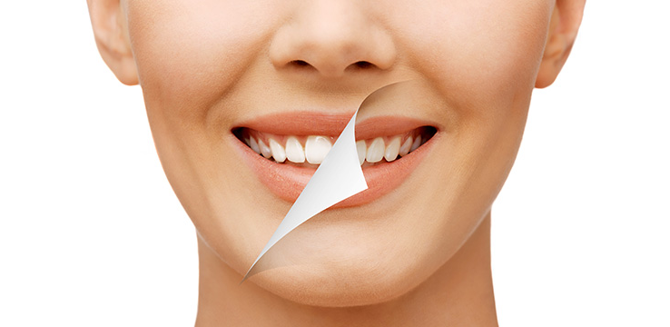 Exciting Tips About Teeth Whitening