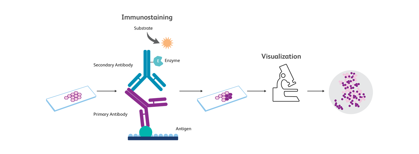 Illustration of Immunohistochemistry