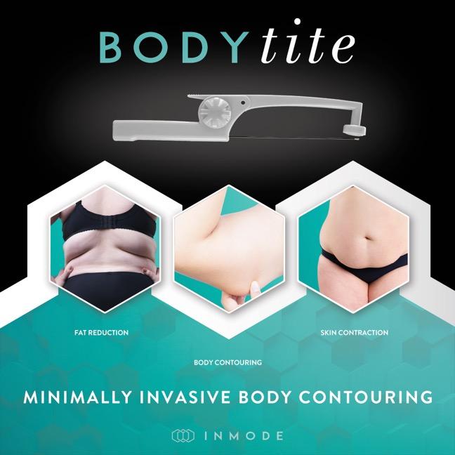 What Is BodyTite By InMode?