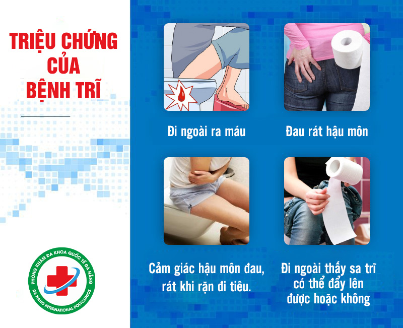 Triệu chứng điển hình của bệnh trĩ