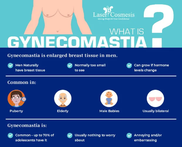 6 Amazing Facts About Gynecomastia